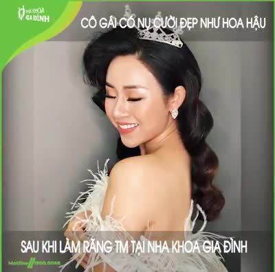 MỸ DUYÊN – CÔ GÁI CÓ NỤ CƯỜI RẠNG NGỜI NHƯ HOA HẬU THÂN THIỆN