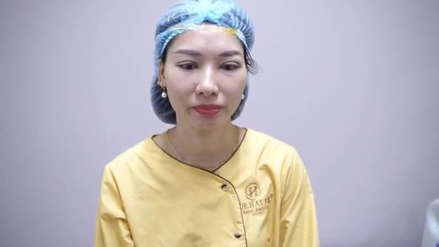 Trường hợp nào nên cắt mí Open để sở hữu đôi mắt đẹp rạng ngời tươi trẻ!