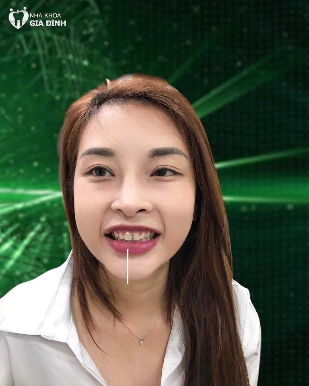 HÀNH TRÌNH TÌM LẠI NỤ CƯỜI MỚI CHỈ SAU 2 NGÀY