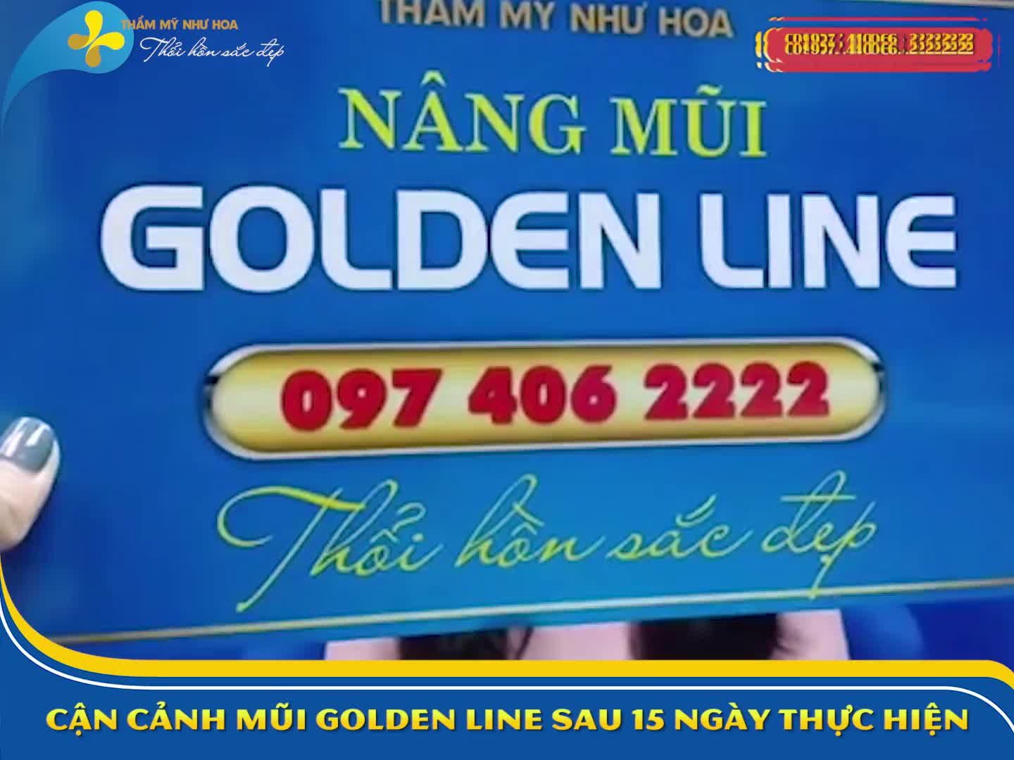 Khuôn mặt chưa đẹp đôi khi là do dáng mũi chưa chuẩn thôi