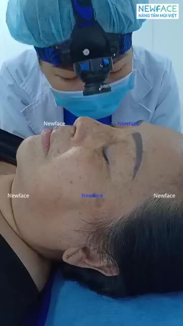 Cô khách Việt kiều Mỹ cứ luôn miệng nói: Ông bác sĩ này cái tay ổng hay lắm. Làm xong mà chẳng thấy đau, thấy sưng gì hết