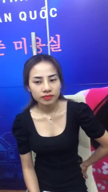 Mũi đẹp toàn diện chỉ sau 10 ngày NÂNG MŨI CẤU TRÚC 4D kết hợp THU NHỎ ĐẦU MŨI