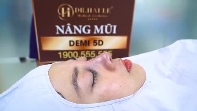 BỊ NGHIỆN VỚI DÁNG MŨI DEMI 5D - ĐẸP HOÀN HẢO MỌI GÓC NHÌN TẠI DR.HẢI LÊ