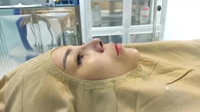 Cận cảnh kết quả sau 30 phút Nâng mũi Pureform