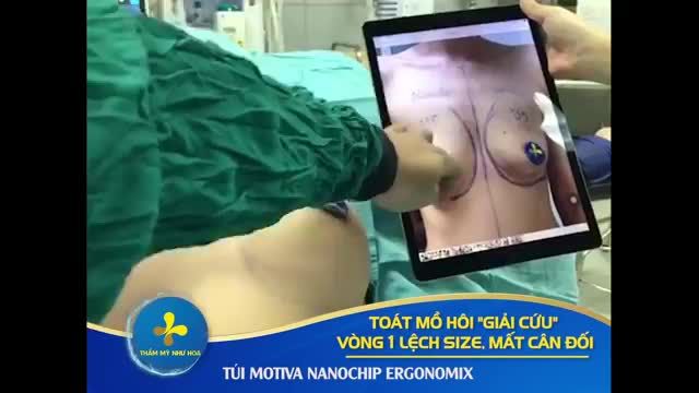 V1 LỆCH SIZE, BÊN TO BÊN NHỎ KHÔNG CÒN LÀ NỖI LO