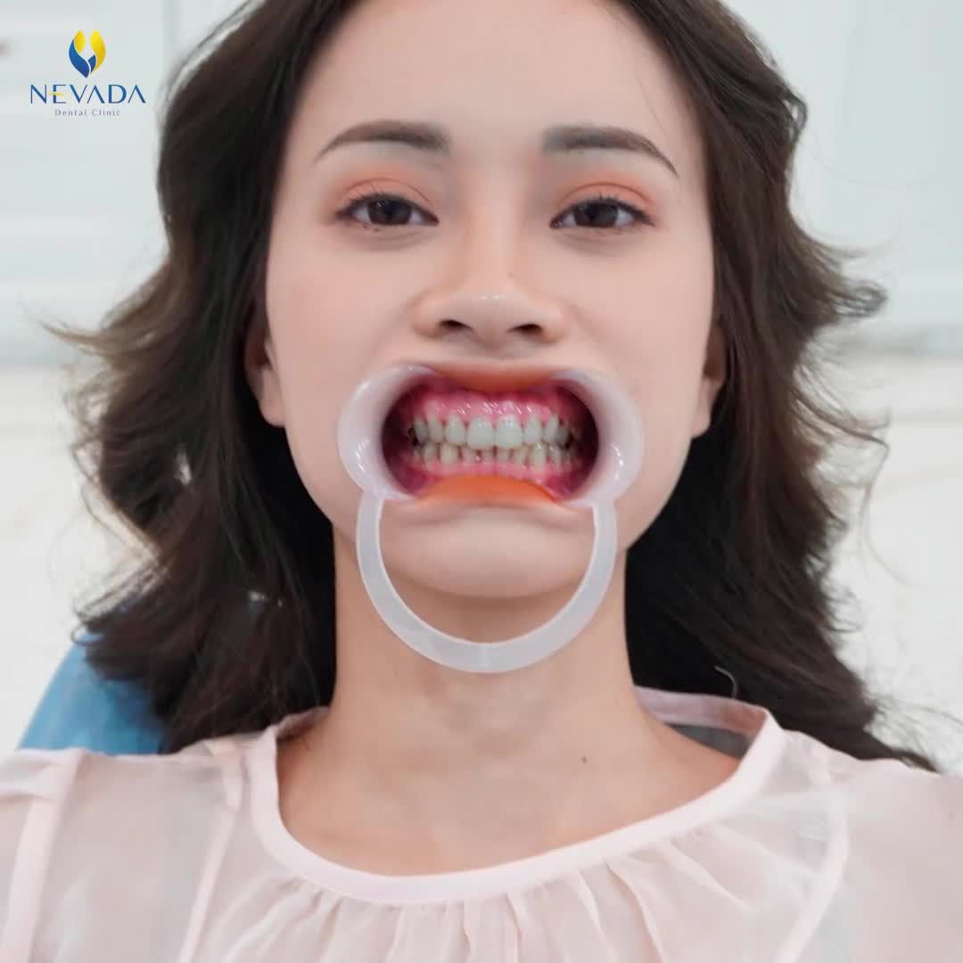 HOA KHÔI MAI PHƯƠNG NÓI GÌ SAU KHI BỌC SỨ TẠI NEVADA