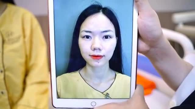 Một nốt nhạc thay đổi đôi mắt nhờ phương pháp Cắt mí Mani Open Deep 5D - Mang đến vẻ đẹp ngoài sự mong đợi của khách hàng!