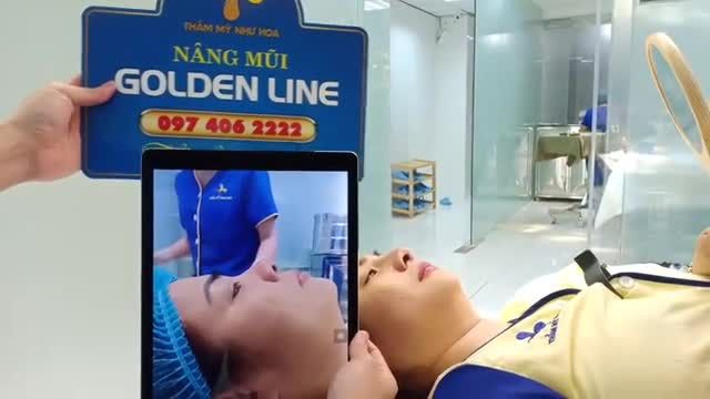 Sau 30 phút nâng mũi Golden Line, diện mạo của cô gái Bùi Thúy Hà thay đổi ra sao