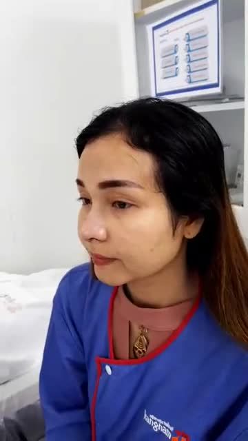 KHÁCH HÀNG NGAY SAU KHI NÂNG MŨI CẤU TRÚC 4D