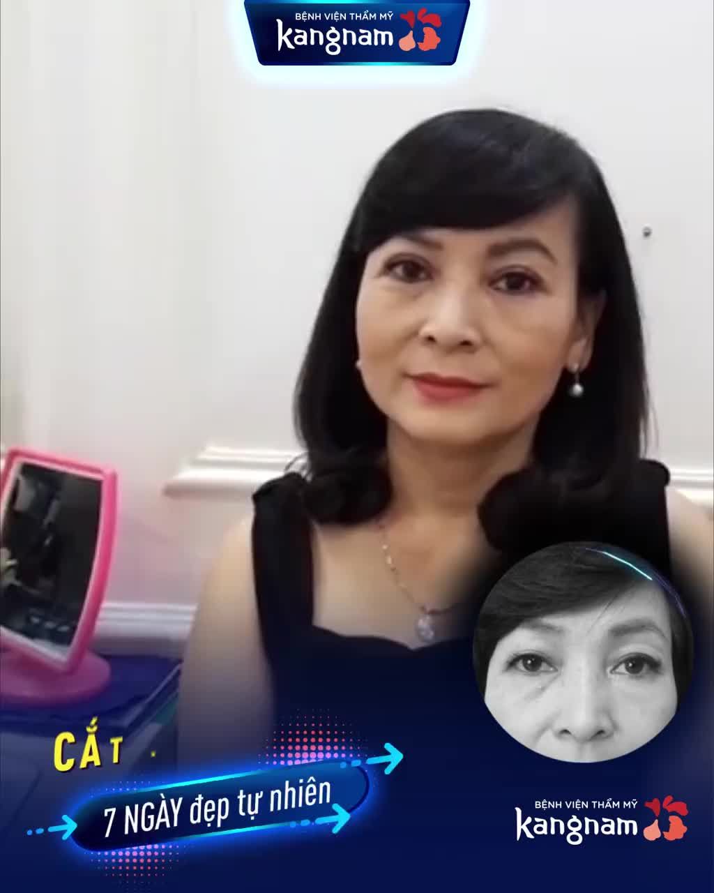 DA CHÙNG - SỤP MÍ TRẺ HÓA MẮT ngoạn mục sau 7 ngày