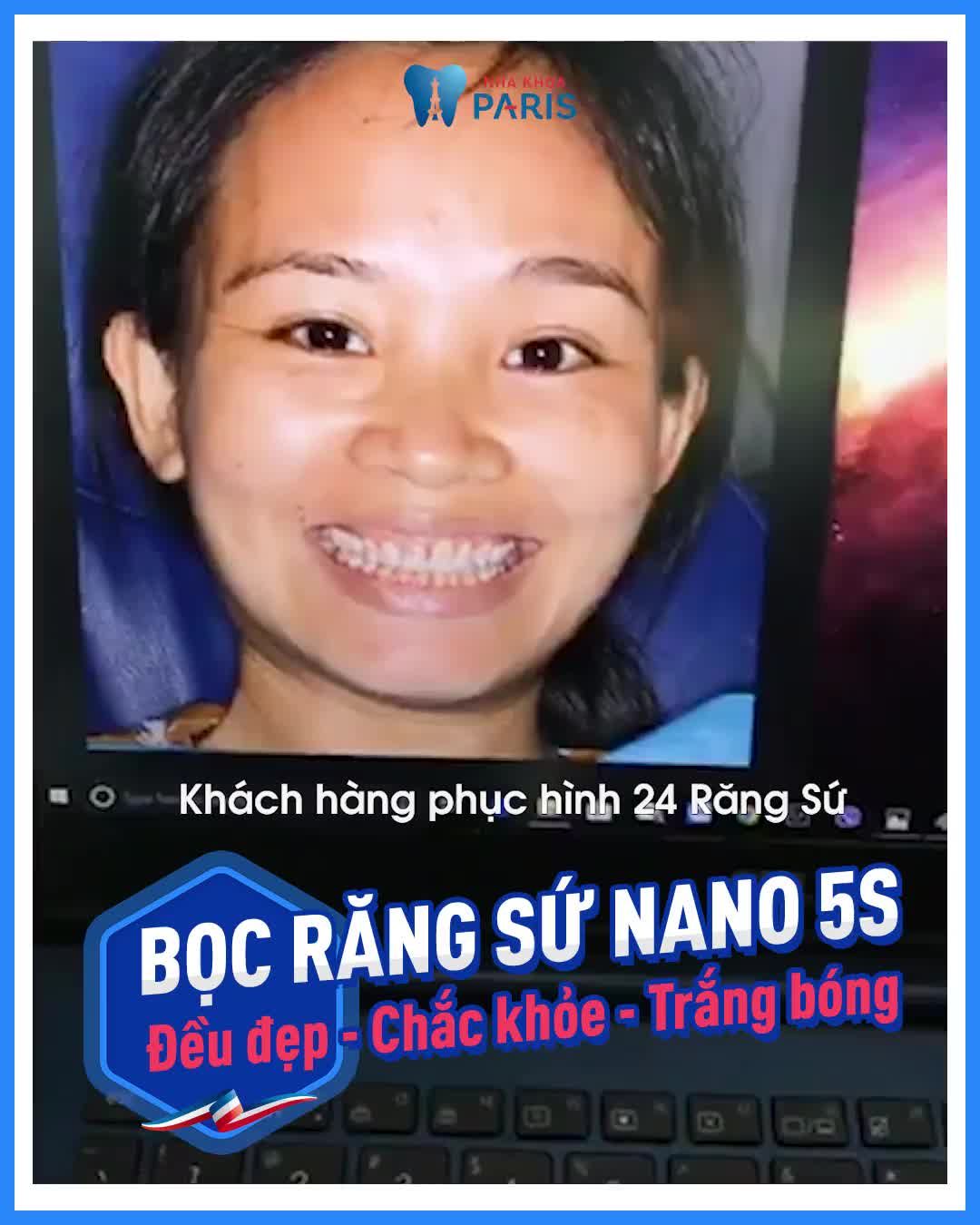 Cận Cảnh Quy Trình Bọc Sứ 24R Lava Khách Hàng Nữ Tại Nha Khoa Paris 97 Cộng Hòa, TP. HCM