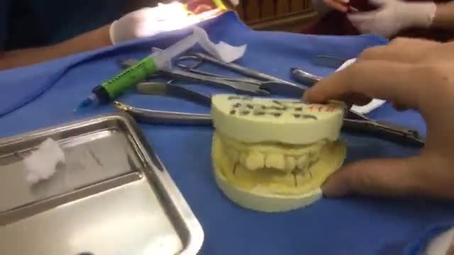 gắn mắc cài cho bạn Bế Văn Đoàn