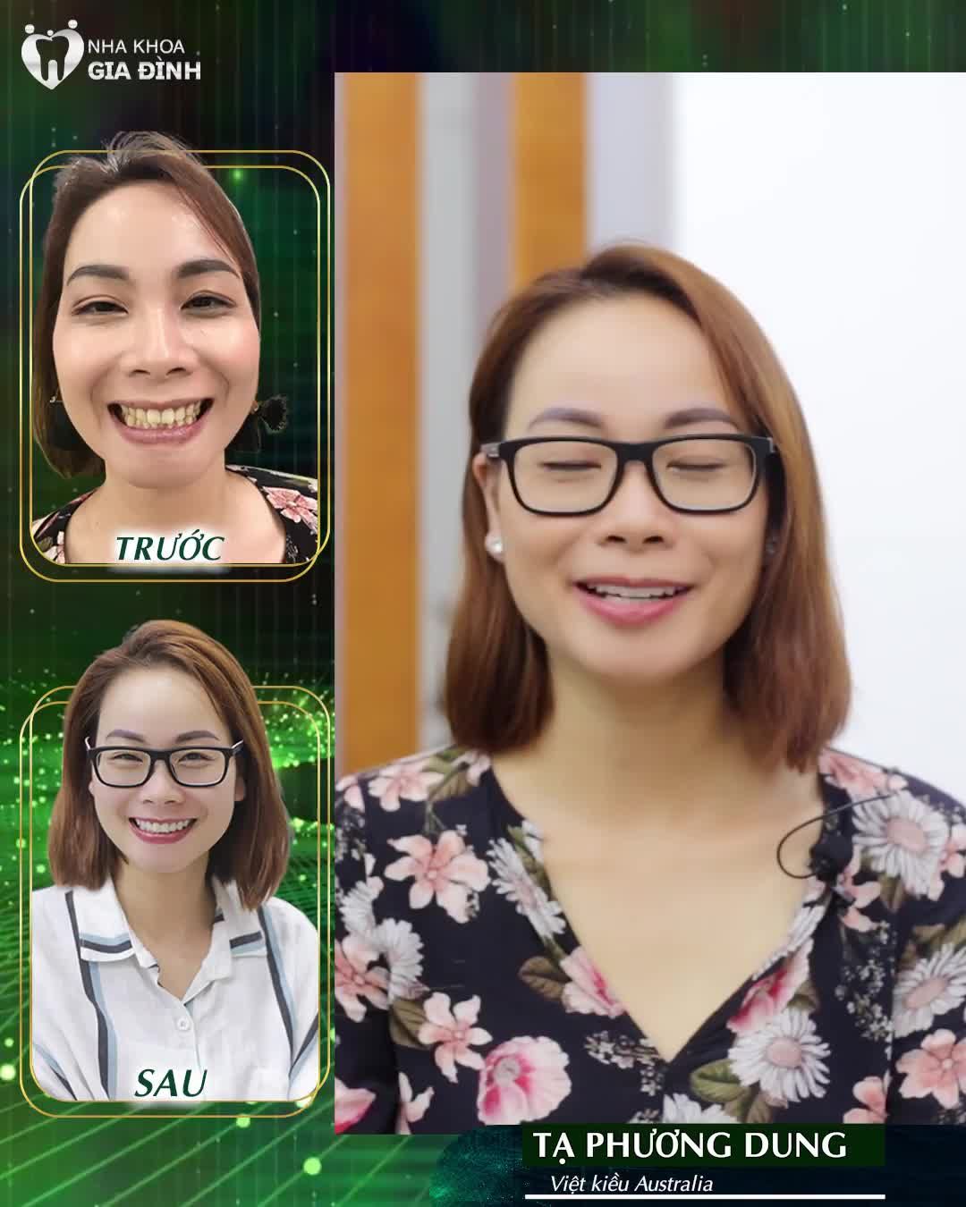 NHA KHOA GIA ĐÌNH – ĐÓN ĐẦU XU HƯỚNG VIỆT KIỀU VỀ NƯỚC LÀM RĂNG