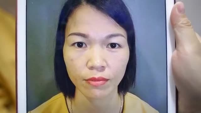 Trường hợp nào nên thực hiện Nâng cung mày để sở hữu đôi mắt thanh tú, loại bỏ triệt để tình trạng da dư sụp mí