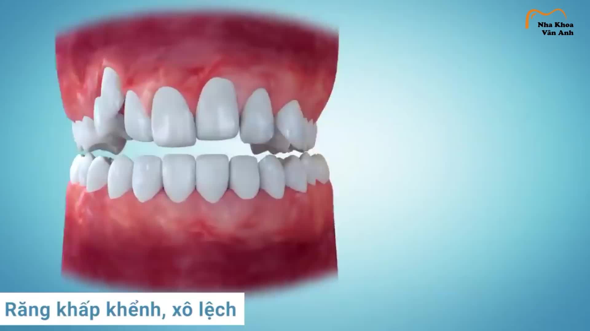 ĐỪNG XEM QUẢNG CÁO, HÃY XEM NHỮNG GÌ CHÚNG TÔI LÀM ĐƯỢC