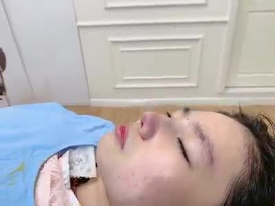 NÂNG MŨI LÓT SỤN ĐA LỚP
