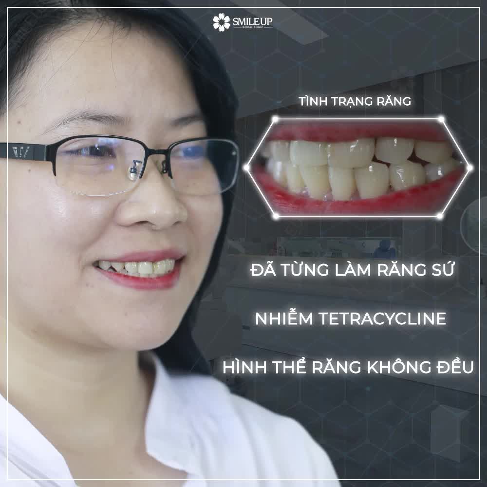 TAỊ SAO NGƯỜI THÀNH CÔNG LẠI CÓ HÀM RĂNG TRẮNG ĐẸP