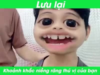 TEAM NIỀNG RĂNG  ĐÂU RỒI