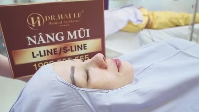 Cận cảnh ca Nâng mũi S-line và thu cánh mũi vừa xong đẹp ngỡ ngàng