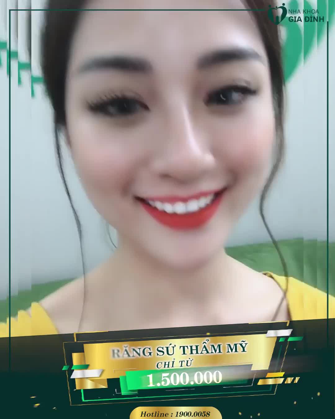 Nắm Bắt Cơ Hội Thẩm Mỹ Răng Sứ Chi Phí Tốt Nhất Năm