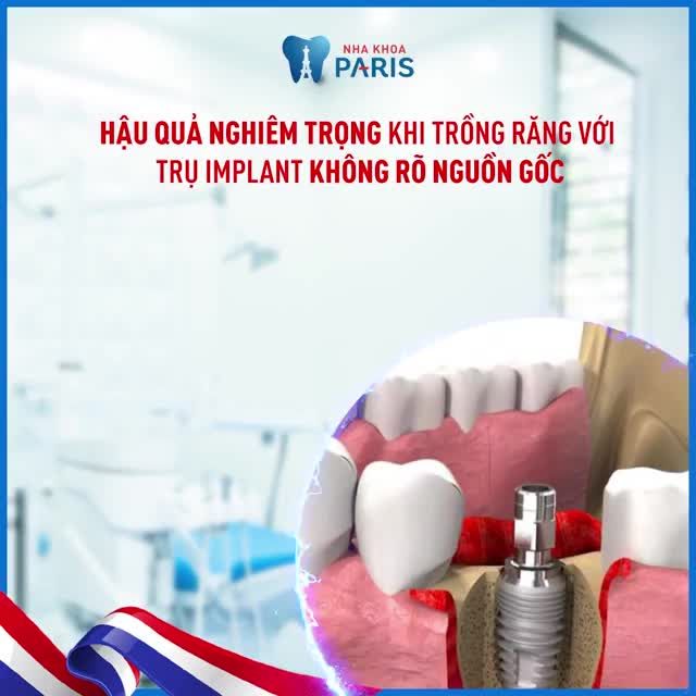 "Sử dụng trụ Implant không chính hãng sẽ gây tổn thương xương hàm, nhanh đào thải và không được bảo hành"