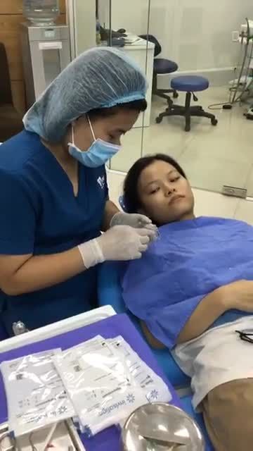 HƯỚNG DẪN ĐEO KHAY INVSALIGN CHỈ 5S