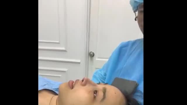 Nâng mũi cấu trúc, kết quả ngay sau mổ