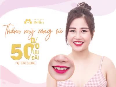 ƯU ĐÃI 50% CHI PHÍ THẨM MỸ RĂNG SỨ