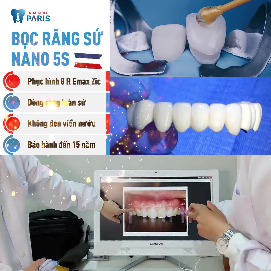 BỌC SỨ TÌM LẠI NỤ CƯỜI THANH XUÂN