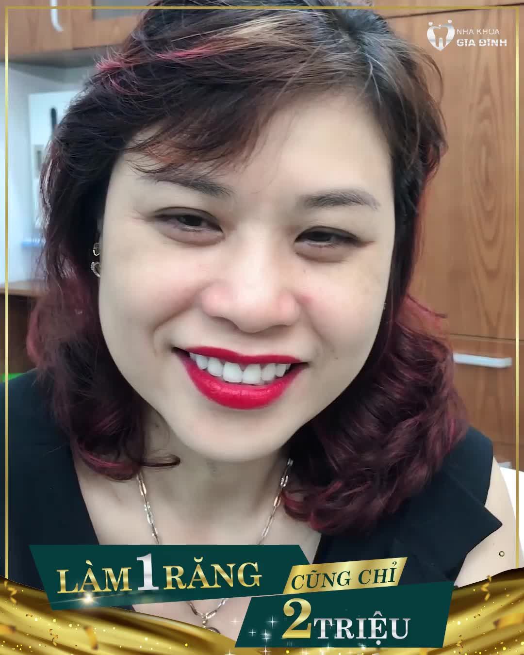 RĂNG NHIỄM KHÁNG SINH CÓ TẨY TRẮNG ĐƯỢC KHÔNG