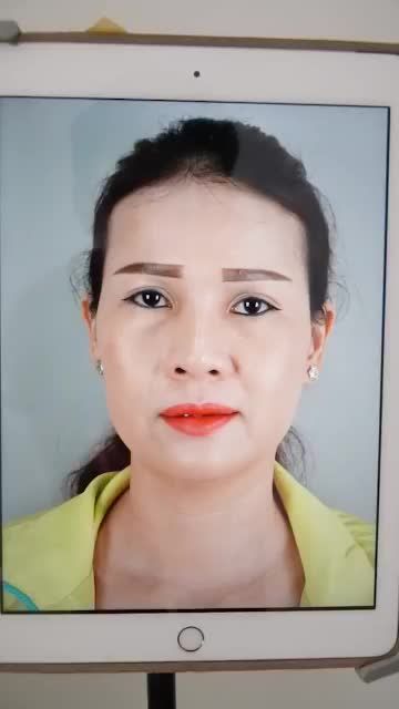 SỬA MŨI HỎNG SAU NÂNG – MŨI ĐẸP KHUÔN MẶT TRẺ TRUNG HƠN