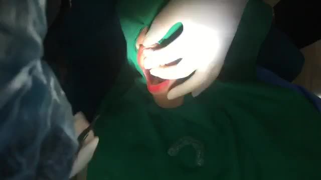 Phẫu thuật cười hở lợi cho chị Phượng đến từ Đại Từ Thái Nguyên.