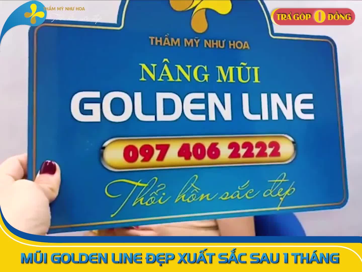 Hình ảnh khách hàng sau 1 tháng NÂNG MŨI GOLDEN LINE