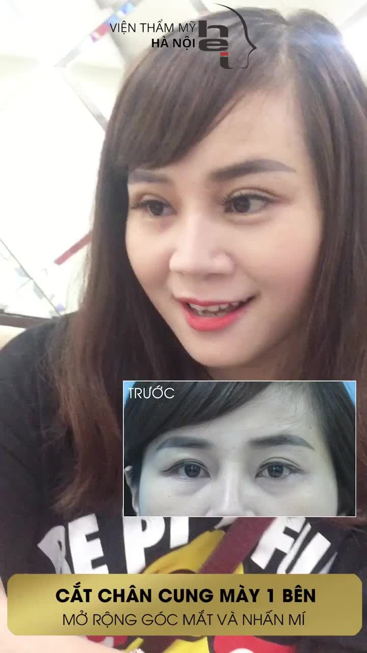 KHÁCH HÀNG BÓC KEO CHÂN MÀY SAU 09 NGÀY