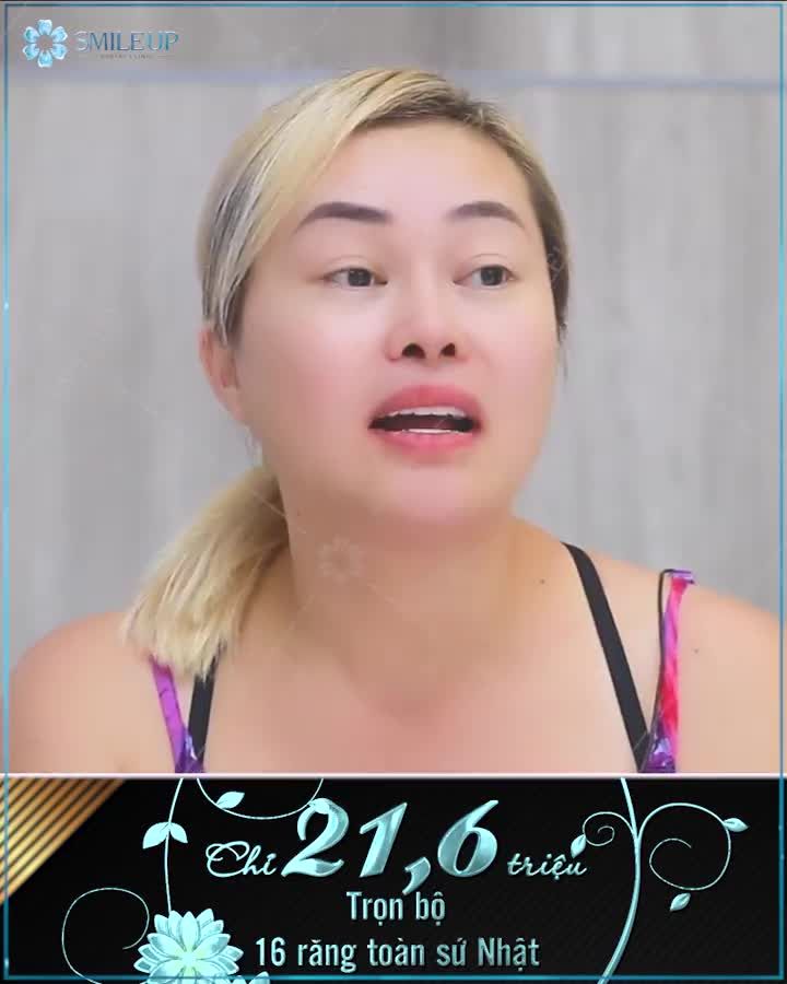 Sở hữu RĂNG TÀI LỘC chỉ 21tr6 trọn bộ 16R