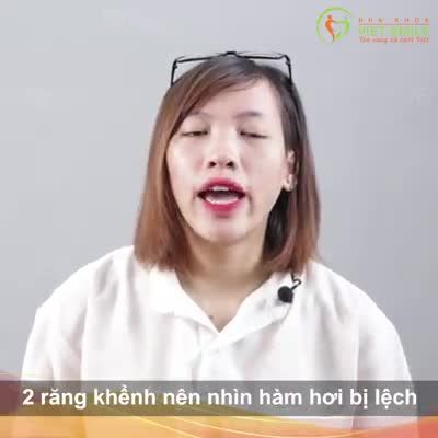 THAY ĐỔI TỪNG NGÀY NHỜ NIỀNG RĂNG