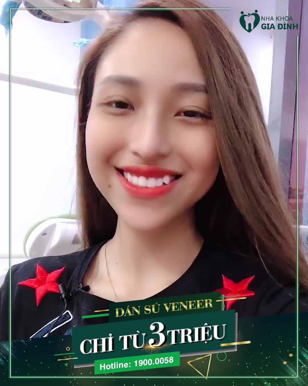 DÁN SỨ VENEER CHỈ TỪ 3TR/RĂNG