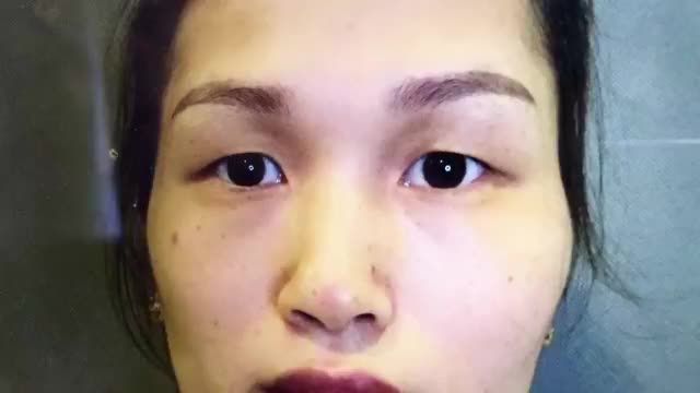 Ngỡ ngàng sau khi cắt mí Mani Mini Deep 5D, đã mang lại cho cô ấy diện mạo mới, không chỉ xinh đẹp mà còn rạng ngời hơn