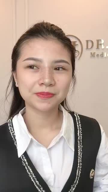 Cùng chiễm ngưỡng vẻ đẹp của vị khách hàng vừa nâng mũi Demi 5D tại Dr. Hải Lê