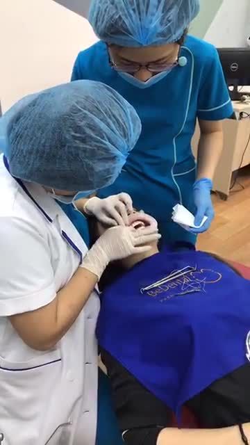 CẬN CẢNH QUY TRÌNH GẮN 16 RĂNG SỨ THẨM MỸ LAVA 3M CHO KHÁCH HÀNG NGỌC HÂN TẠI BEDENTAL