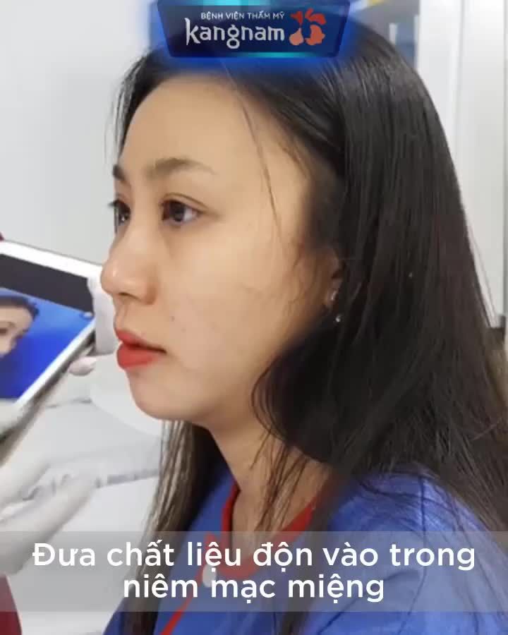 Nếu không gặp chị khách này tại Kangnam, bạn sẽ không nhận ra chị ấy đã ĐỘN CẰM... vì QUÁ TỰ NHIÊN!