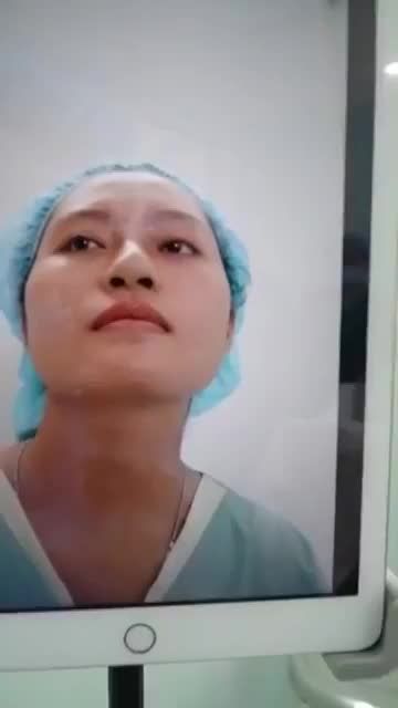 MŨI HỎNG SỬA LẠI SAU 90 PHÚT ĐẸP CHẲNG KHÁC GÌ MŨI MỚI NÂNG LẦN ĐẦU