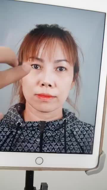 KHÁCH NÂNG MŨI CẤU TRÚC SỬA LẠI ĐẾN TÁI KHÁM