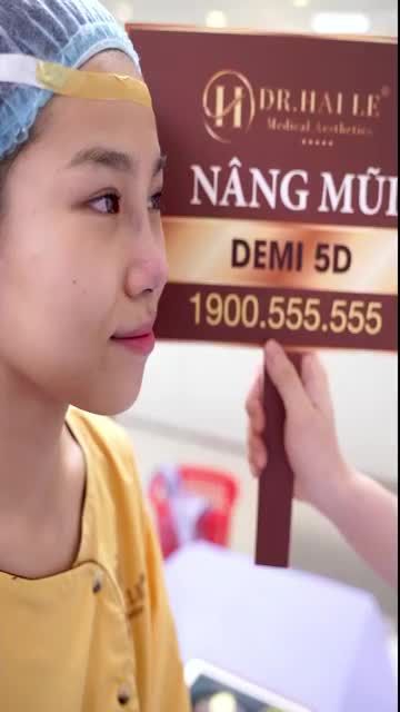 Cùng chiêm ngưỡng kết quả ngoài sức mong đợi của khách hàng vừa nâng mũi Demi 5D tại Dr. hải lê
