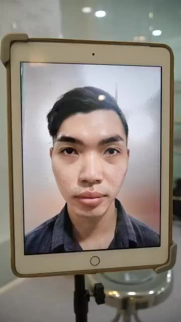 SAU 45P NÂNG MŨI CẤU TRÚC – MŨI CAO CHUẨN NAM TÍNH, KHÔNG SƯNG BẦM