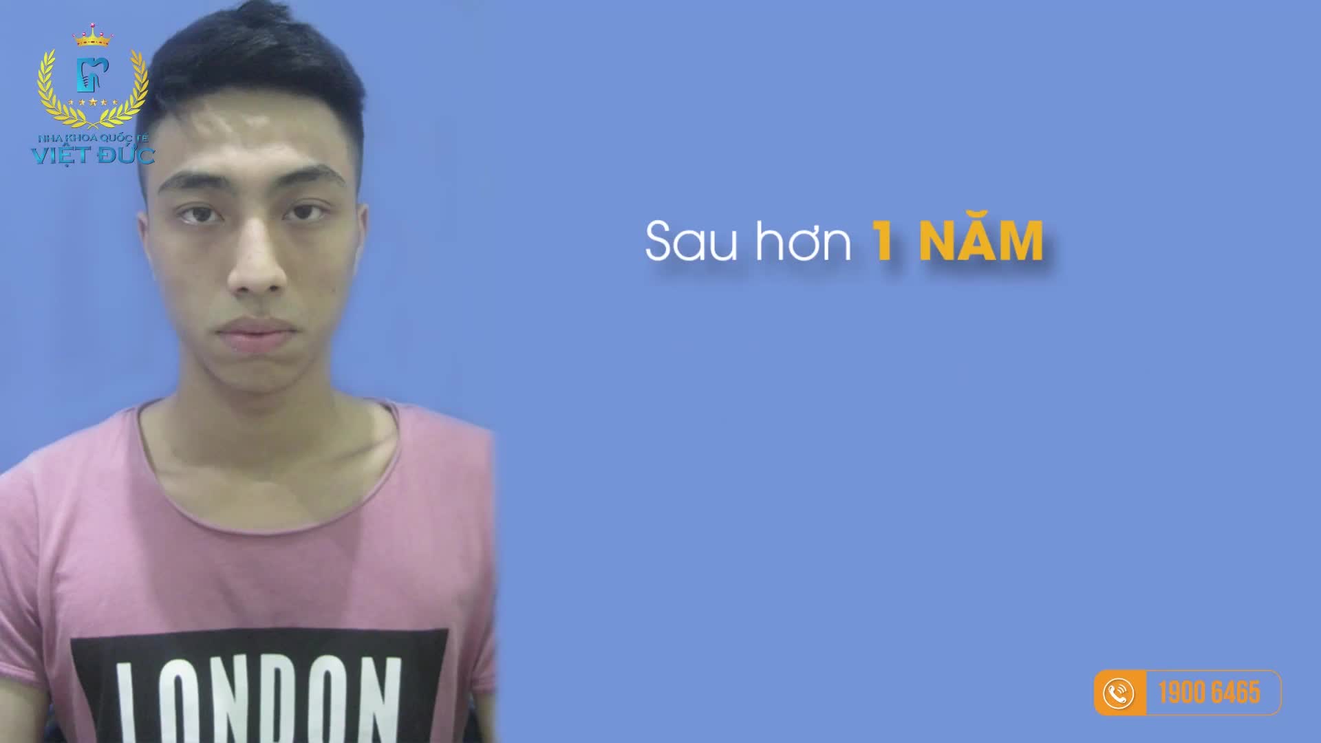 KẾT QUẢ NIỀNG RĂNG ĐẸP NHƯ NÀY CÓ ĐỦ KÍCH THÍCH BẠN KHÔNG