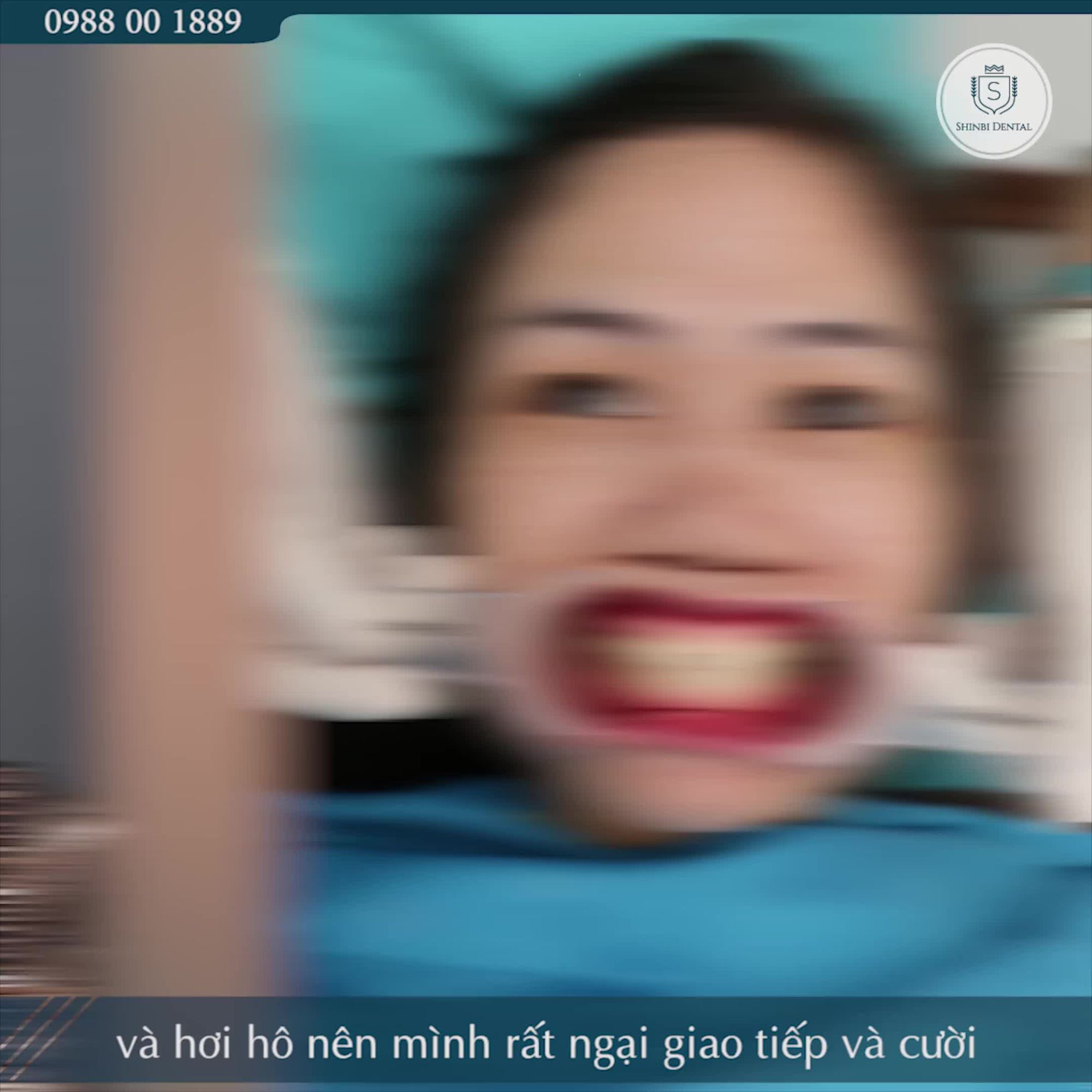 NGHE BÁC SĨ HÒA TƯ VẤN TÔI HOÀN TOÀN YÊN TÂM VÀ QUYẾT ĐỊNH ĐẾN SHINBI ĐỂ LÀM RĂNG SỨ THẨM MỸ