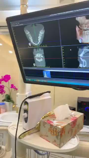 Nhổ Răng và cấy ghép tức thì implant R21 straumann “ Thụy sỹ “ hãng implant hiện đại Và tốt nhất trên thế giới hiện nay