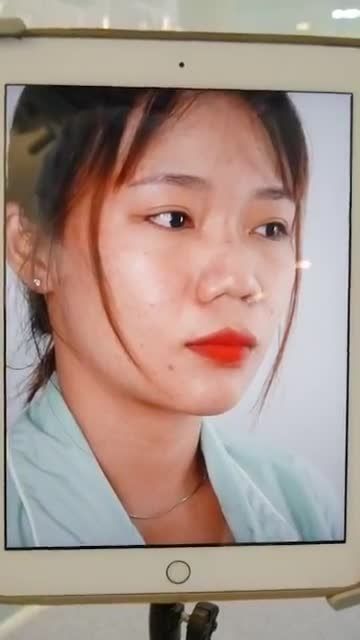 NÂNG MŨI CẤU TRÚC - - LOẠI BỎ NGAY TÌNH TRẠNG MŨI NGẮN, HẾCH, TẸT