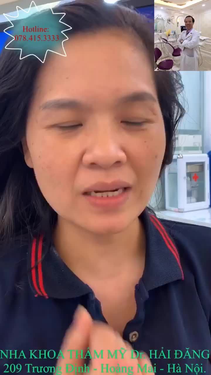 Những chiếc răng cửa to thô mất cân đối làm bạn mất tự tin.